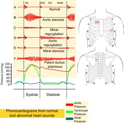 File Phonocardiograms From Normal And Abnormal Heart Sounds With | Best ...