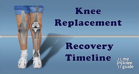 Road to Recovery following Knee Replacement | Knee replacement recovery ...