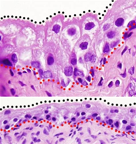 Transitional Epithelium Tissue