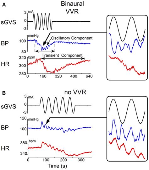 Frontiers | Vasovagal Oscillations and Vasovagal Responses Produced by the Vestibulo-Sympathetic ...