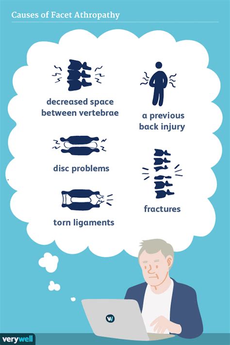 Facet Arthropathy Symptoms and Treatments