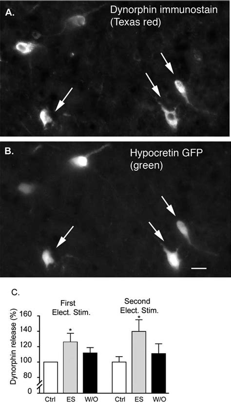 Dynorphin release from dorsal lateral hypothalamus. A, Photomicrograph... | Download Scientific ...