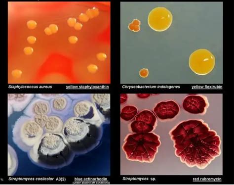 types of bacteria colonies