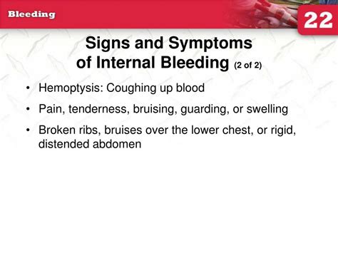 PPT - 22: Bleeding PowerPoint Presentation, free download - ID:4562476