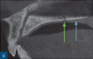 Dentoalveolar Anatomy | Pocket Dentistry