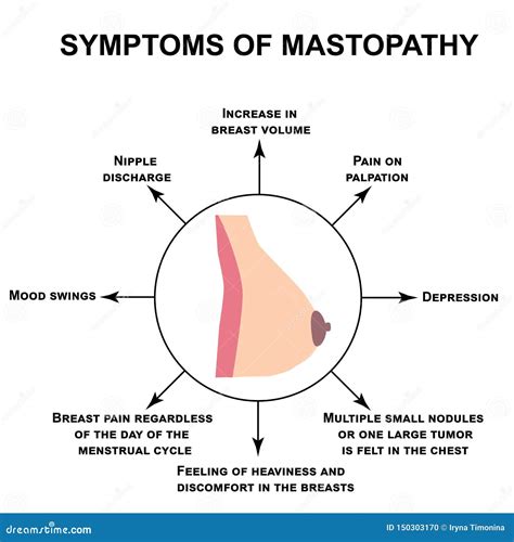 Symptoms of Mastopathy. World Breast Cancer Day. Infographics. Vector ...