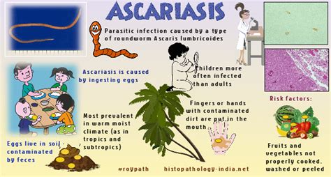 Pathology of Ascariasis - Dr Sampurna Roy MD