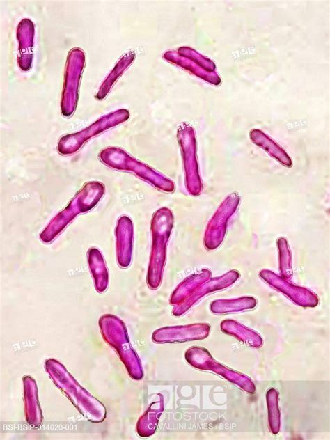 botulinum bacteria spores - Google Search | Spore, Clostridium ...