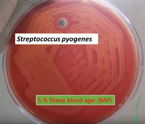 Blood agar: Introduction, composition, preparation, principle and interpretat