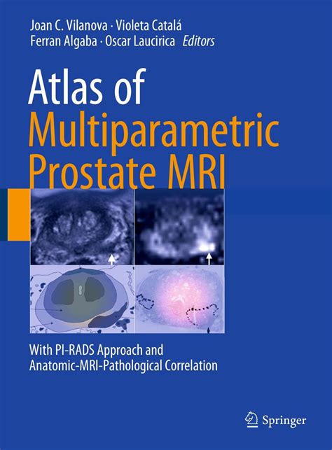 Atlas Of Multiparametric Prostate MRI With PI RADS Approach And Anatomic MRI Pathological ...