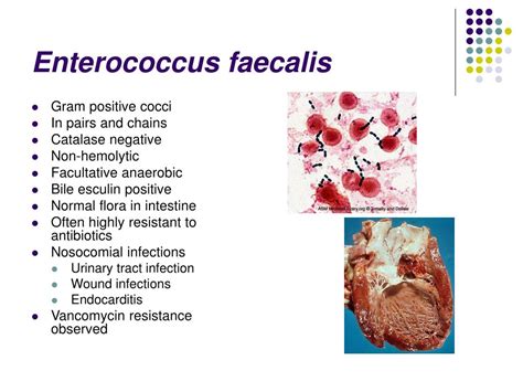 Enterococcus Faecalis Vs Faecium