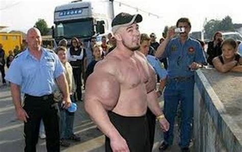 Synthol Gone Wrong (57 photos) | KLYKER.COM