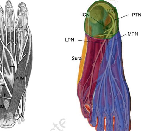 Nervio Plantar Lateral