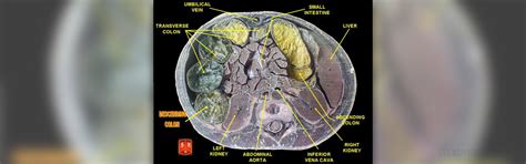 About colon spasms | General center | SteadyHealth.com