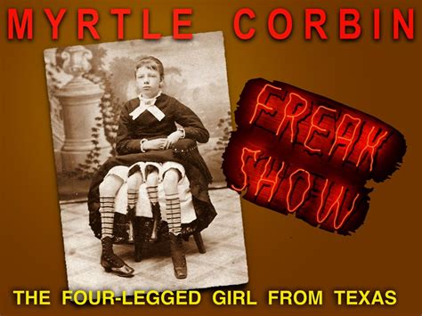 DOGBRINDLE.COM : Myrtle Corbin Was A Real Freak — She Had One Husband ...