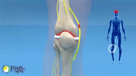 What Is A Nerve Block In The Knee - mapageprek