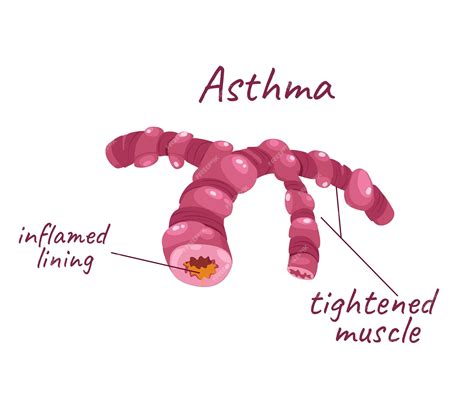 Premium Vector | Concept human anatomy organ lungs the illustration is ...