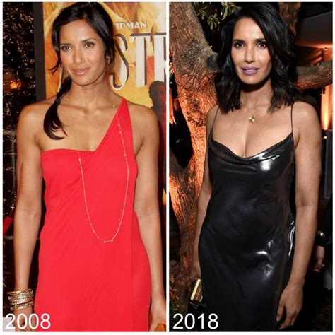 Padma Lakshmi Plastic Surgery? — Experts Weigh in on Top Chef Host!