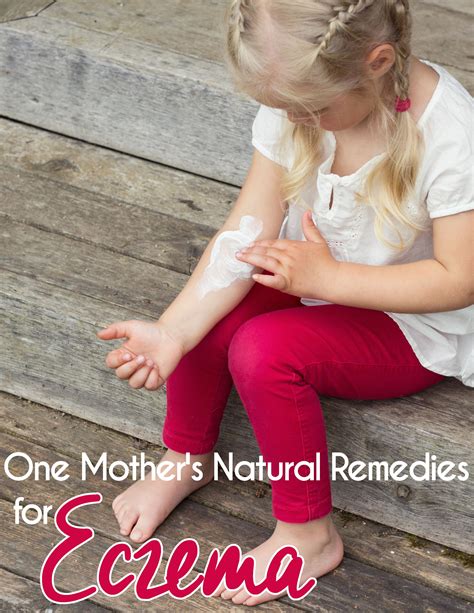 Avoiding the Eczema Winter Blues | Natural eczema remedies, Eczema remedies, Natural remedies