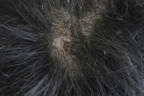 How Do You Treat Flea Allergy Dermatitis In Dogs