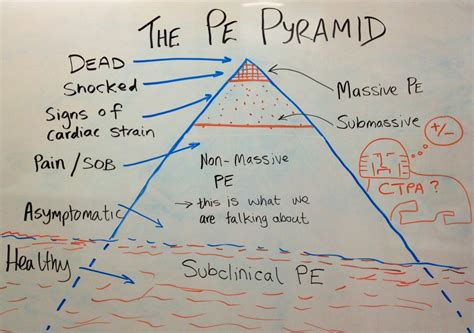 PE Prognostication with Dr Anand Senthi - Broome Docs