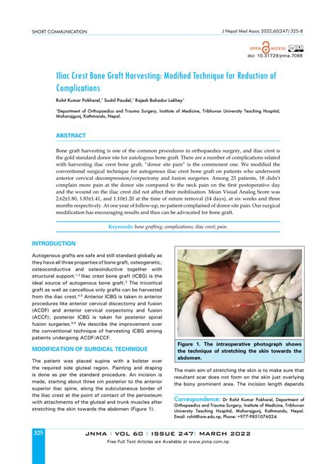 (PDF) Iliac Crest Bone Graft Harvesting: Modified Technique for Reduction of Complications