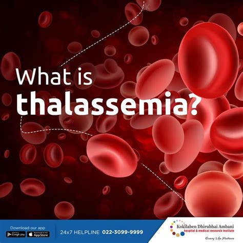 Thalassemia minor - moligraphic