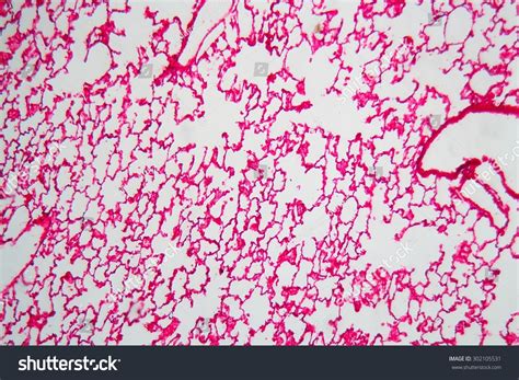 Lung Cells Under Microscope Stock Photo 302105531 | Shutterstock