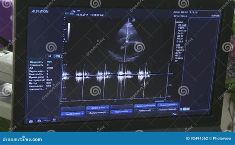 Medical Ultrasound Scan Heart Echocardiogram Stock Footage - Video of echo, background: 92494562