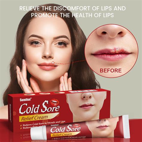 Cold Sore Relief Cream Cheilitis Lips Relief Cream Repair lip Dry Chapped Cracked Peeling Lips ...