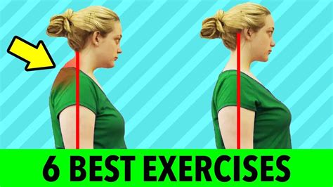 6 Best Exercises For Neck Hump - Get Rid Of Hump On Back Of Neck - YouTube