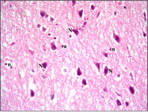 Section in the cerebral cortex of a control rat showing pyramidal ...