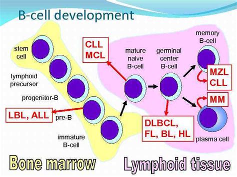 Chronic lymphocytic leukemia Chronic Lymphocytic Leukemia Small