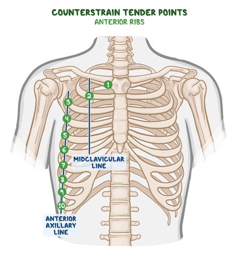 Anterior Counterstrain Points