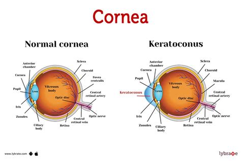 Cornea Image (Human Anatomy): Picture, Functions, Diseases, and Treatments