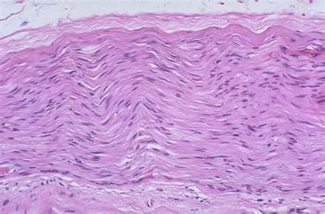 Peripheral Nerve Histology Cross Section