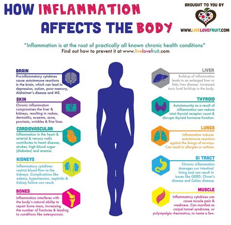 Pin on Keto/low carb Diet