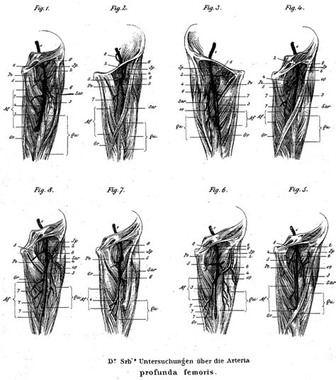 Image of profunda femoris artery variations