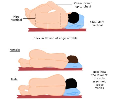 Patient Positioning Lateral Position