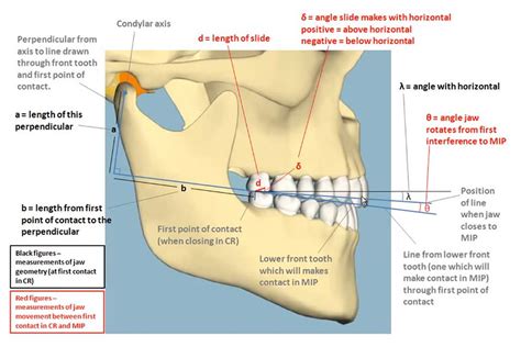 OCCLUSION: Condylar Axis Movement from Centric Relation to MIP