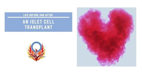 islet cell transplant blog - Diabetes Advocacy