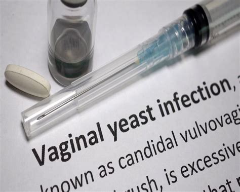 Vaginal Yeast Infection Cure