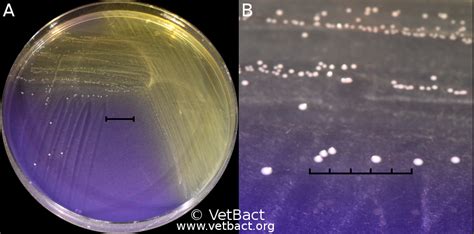 Streptococcus dysgalactiae subsp. dysgalactiae