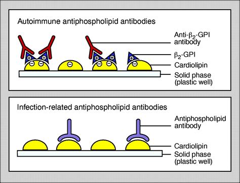 Antiphospholipid syndrome: an overview | CMAJ