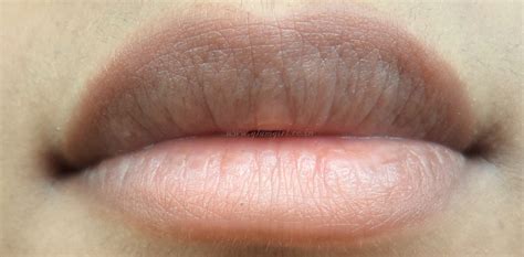 Lip Pigmentation Causes and Home Remedies