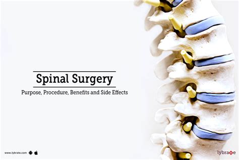 Spinal Surgery: Types, Recovery, Risks, and Benefits