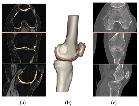 "Advanced MRI Scan of the Knee in Alamogordo: A Comprehensive Look at Your Joint Health" - Filyr