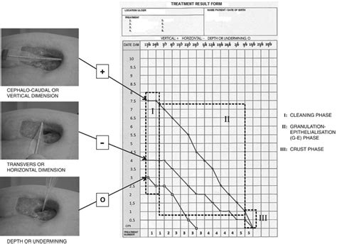 Measurement of length, width and depth of a PU, registered with a ‘+’,... | Download Scientific ...