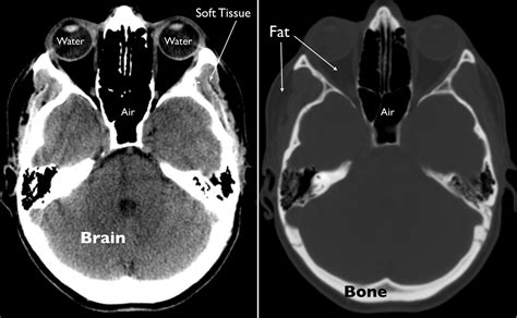 HEALTH FROM TRUSTED SOURCES: Brain : CT MRI