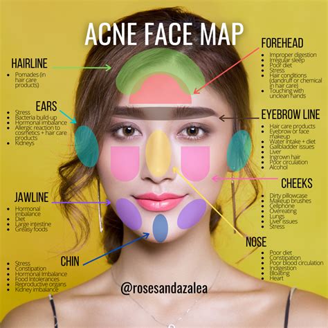 Natural Face Skin Care, Body Skin Care, Acne Mapping, Pimple Face Mapping, Face Mapping Acne ...
